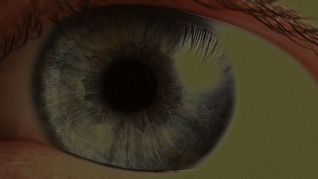Eye